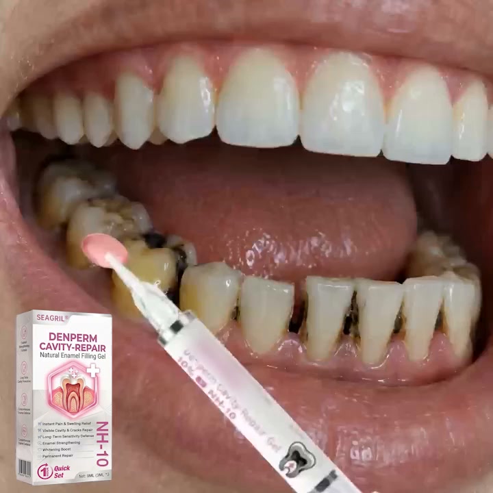 Cavity Repair √FDA-Recognized 10% Nano-Hydroxyapatite (NH-10) |Delivery within 2-4 working days | Full refund guarantee
