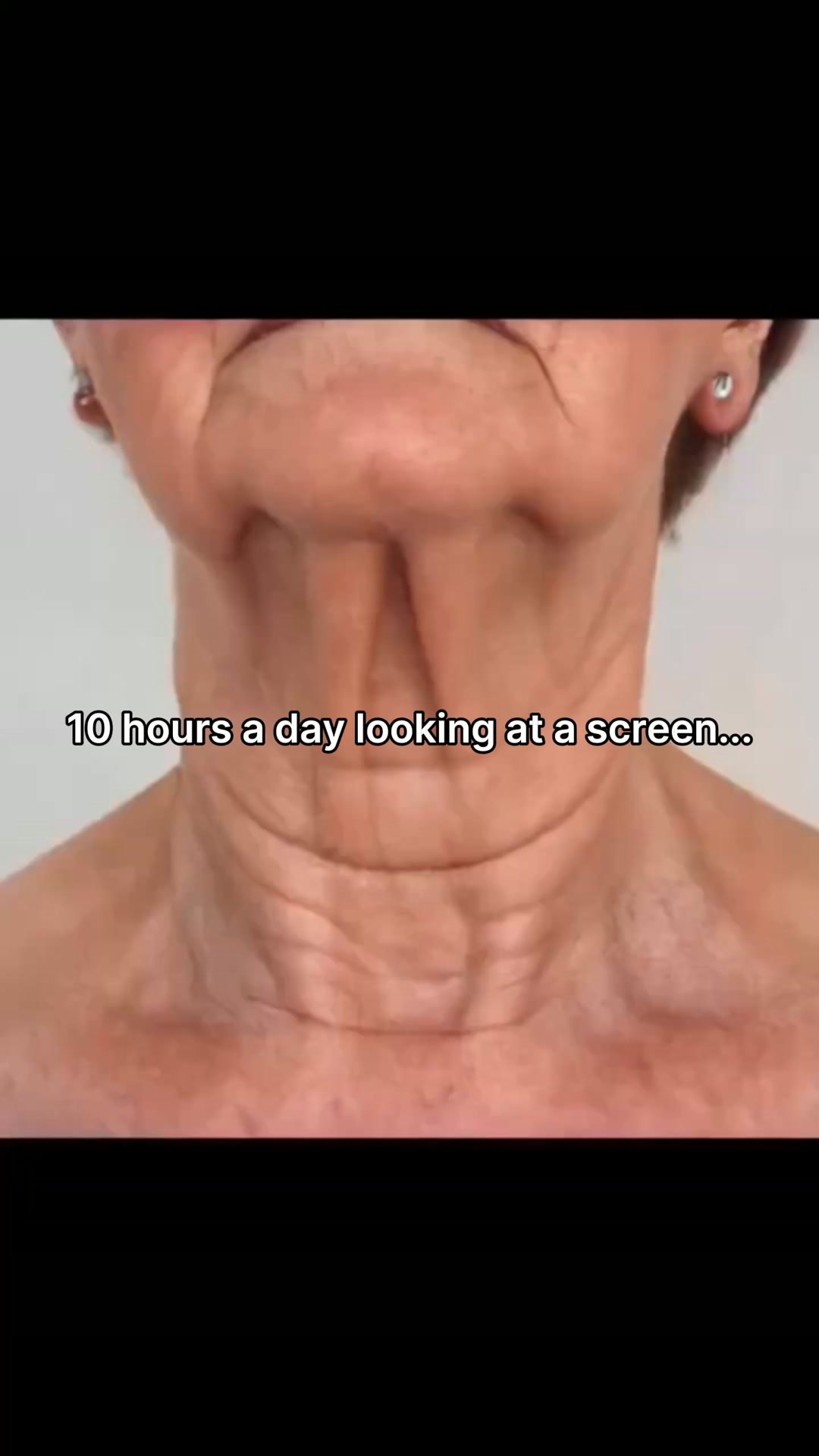 Nobody Tells You Why Neck Creams Stop Working