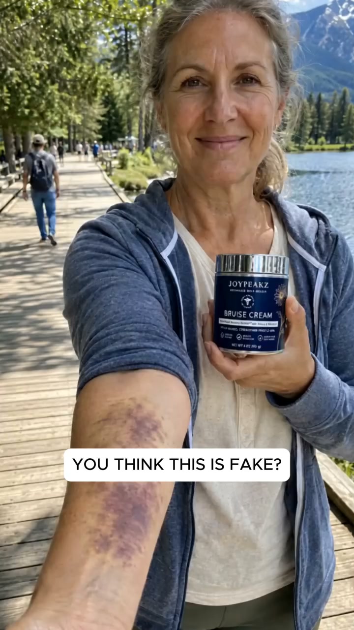 The Truth About "Miracle" Bruise Creams