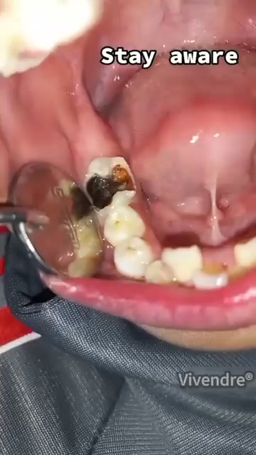 The Future Of At-Home Tooth Care Is Here