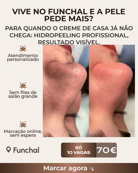 Veja o que uma sessão faz pela sua pele