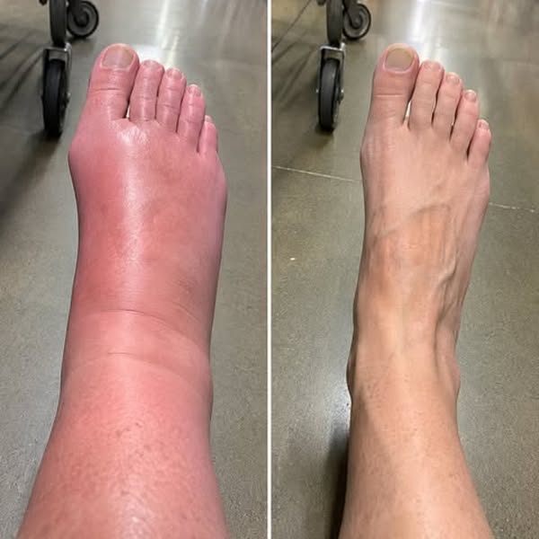 She poured the last of the wine down the sink the same afternoon she got the diagnosis. Six months later the numbers were worse.