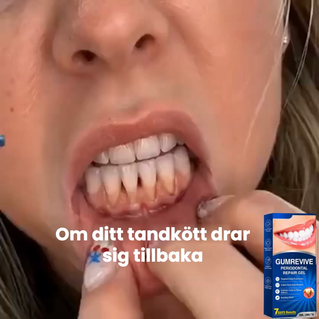 50% RABATT