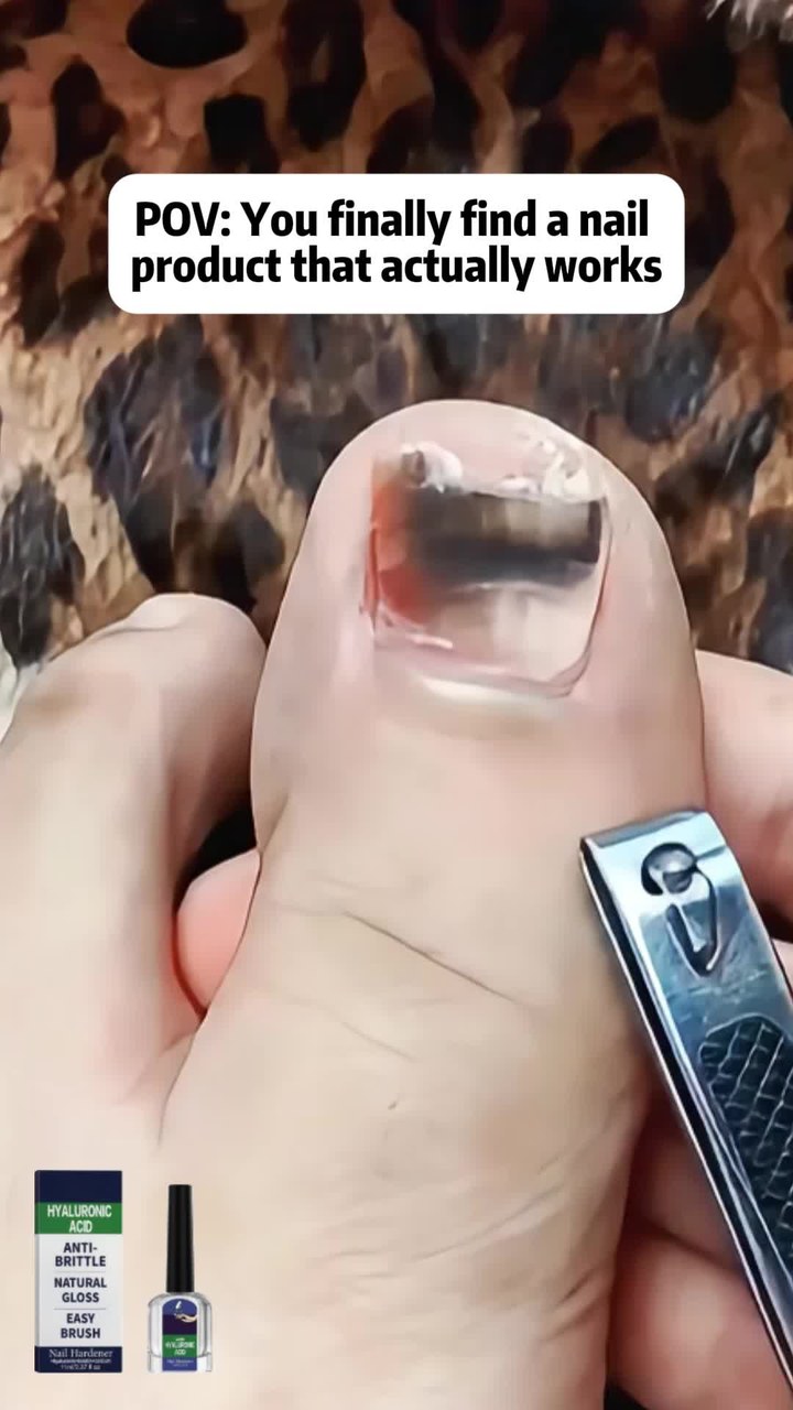 Antifungal Nail Repair Solution