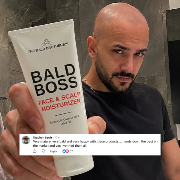 No More Itchy Scalp for Bald Men