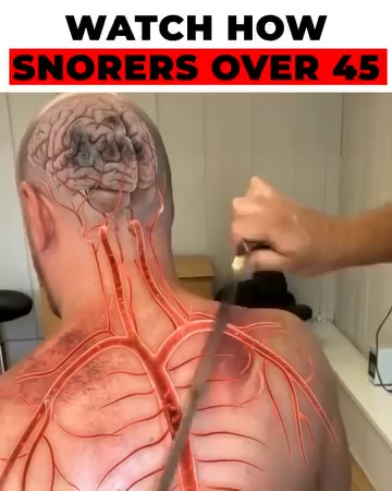 The smarter way to stop snoring!