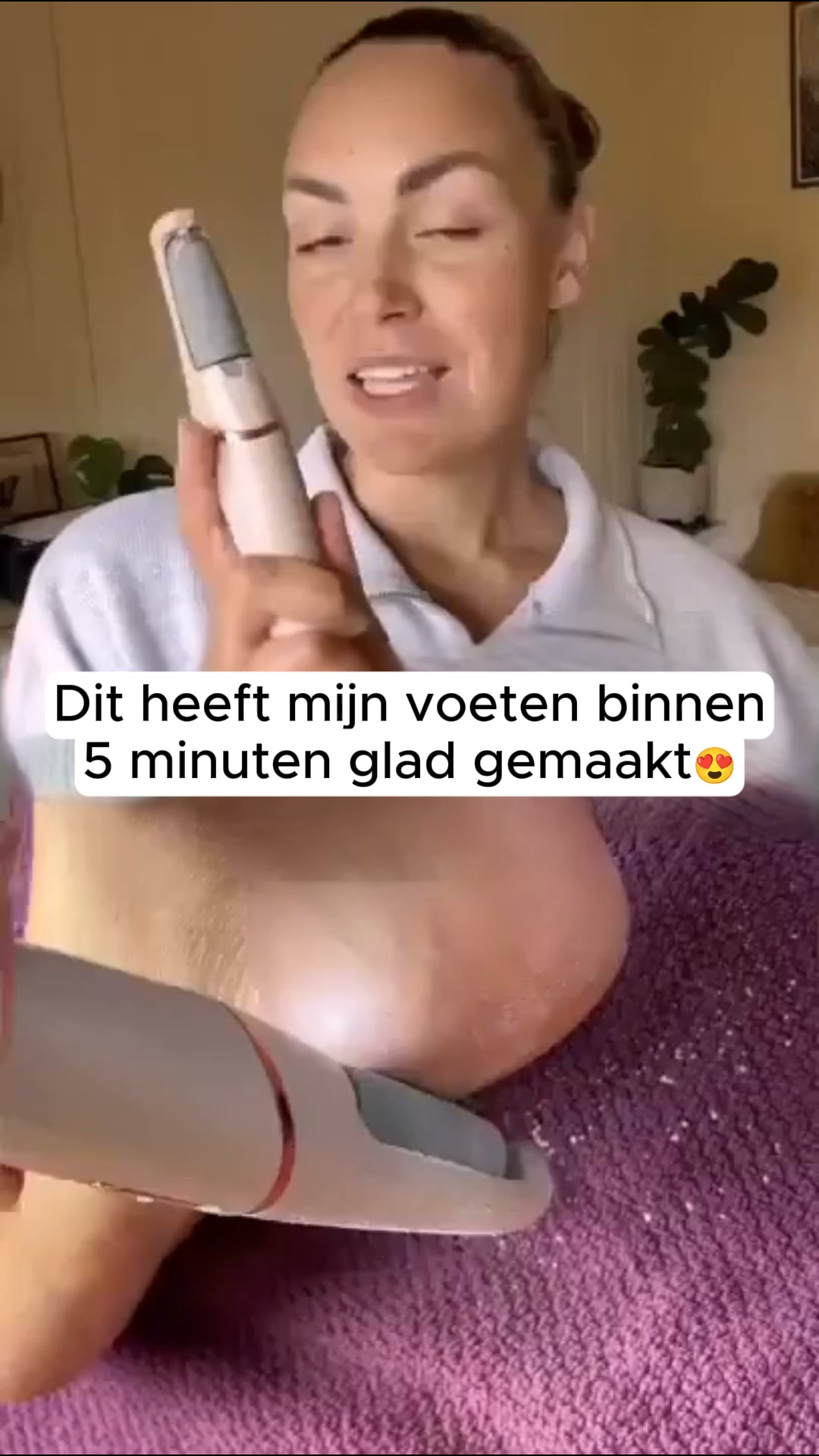 Alles geprobeerd tegen eelt?