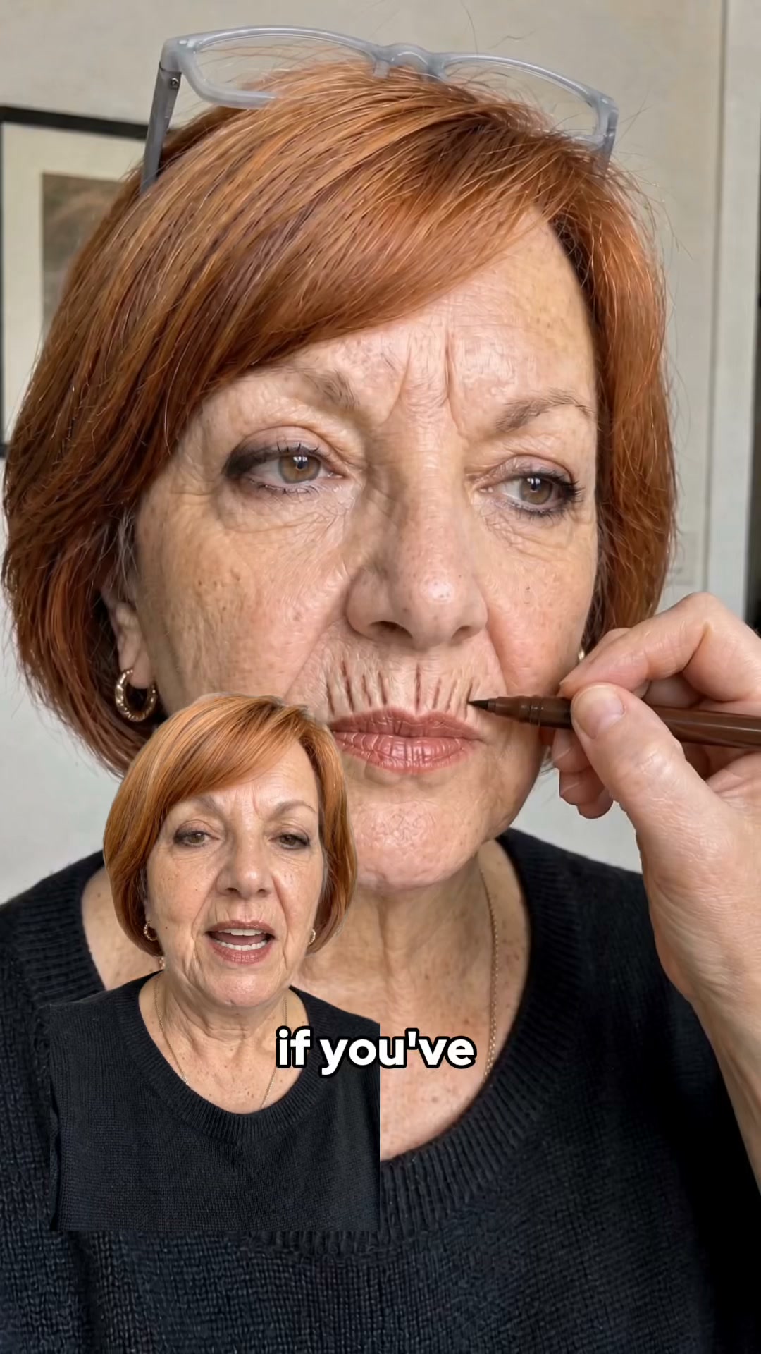 No More Lip Lines