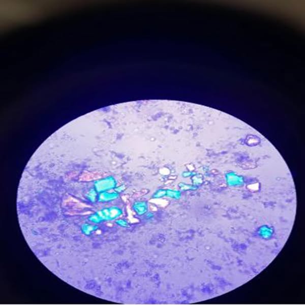 Good News for Every Woman with Recurring UTIs
