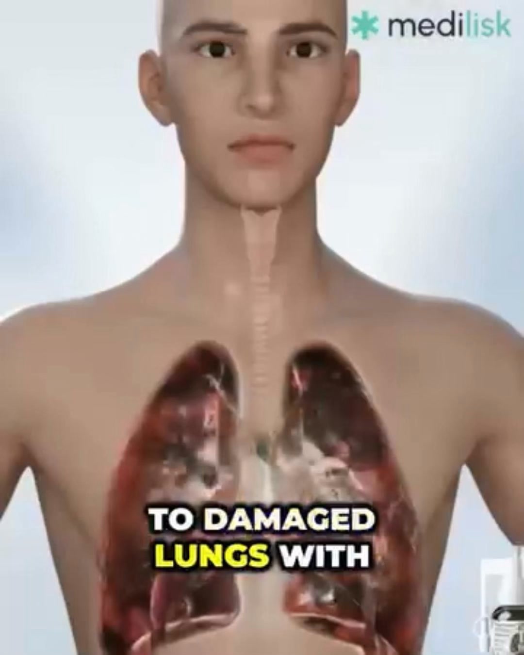 Tired of swallowing handfuls of supplement pills? Breathe easier with BreathVita Lung Ease Spray.