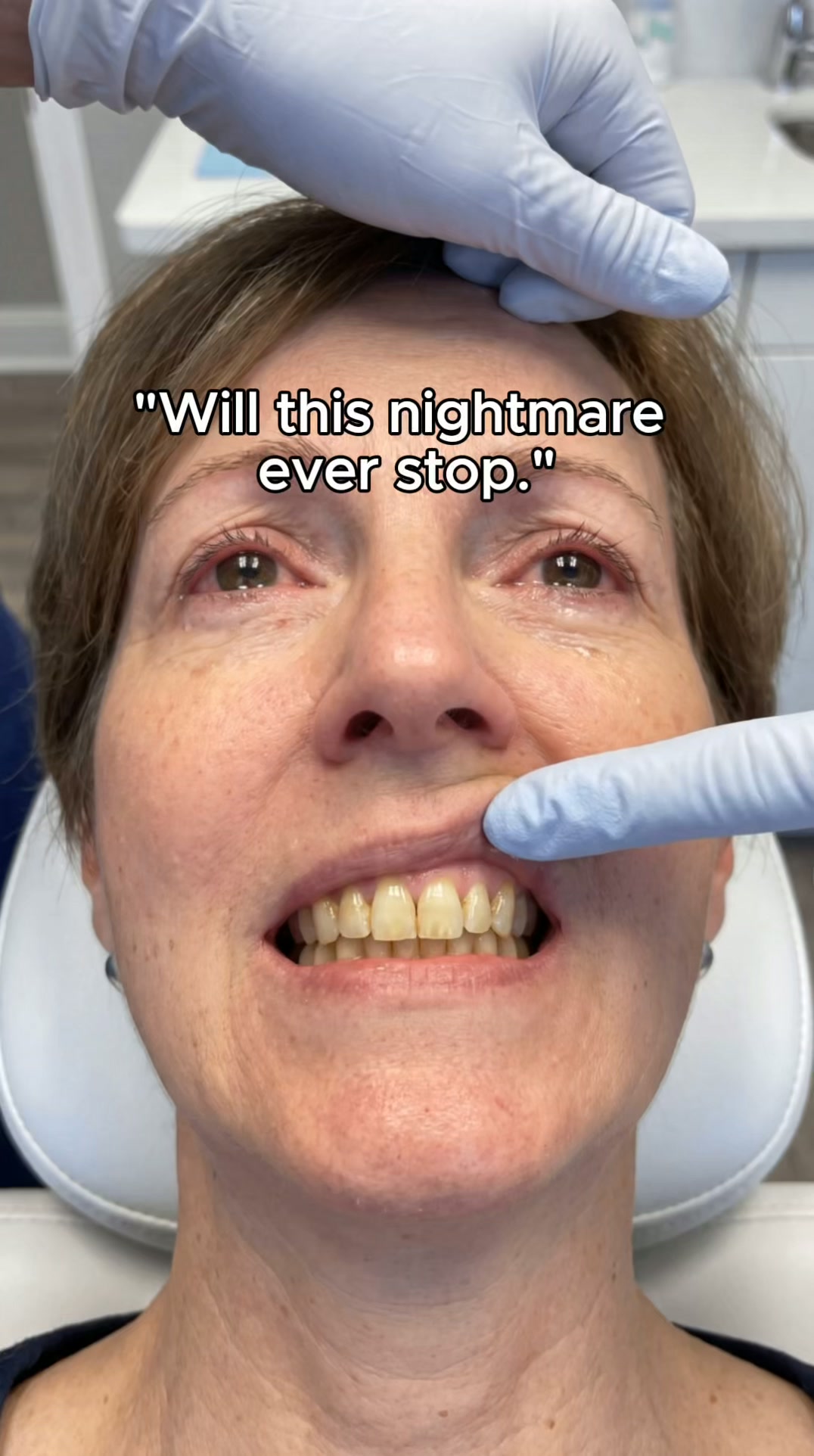 Steal Your Youthful Smile Back In 30 Seconds