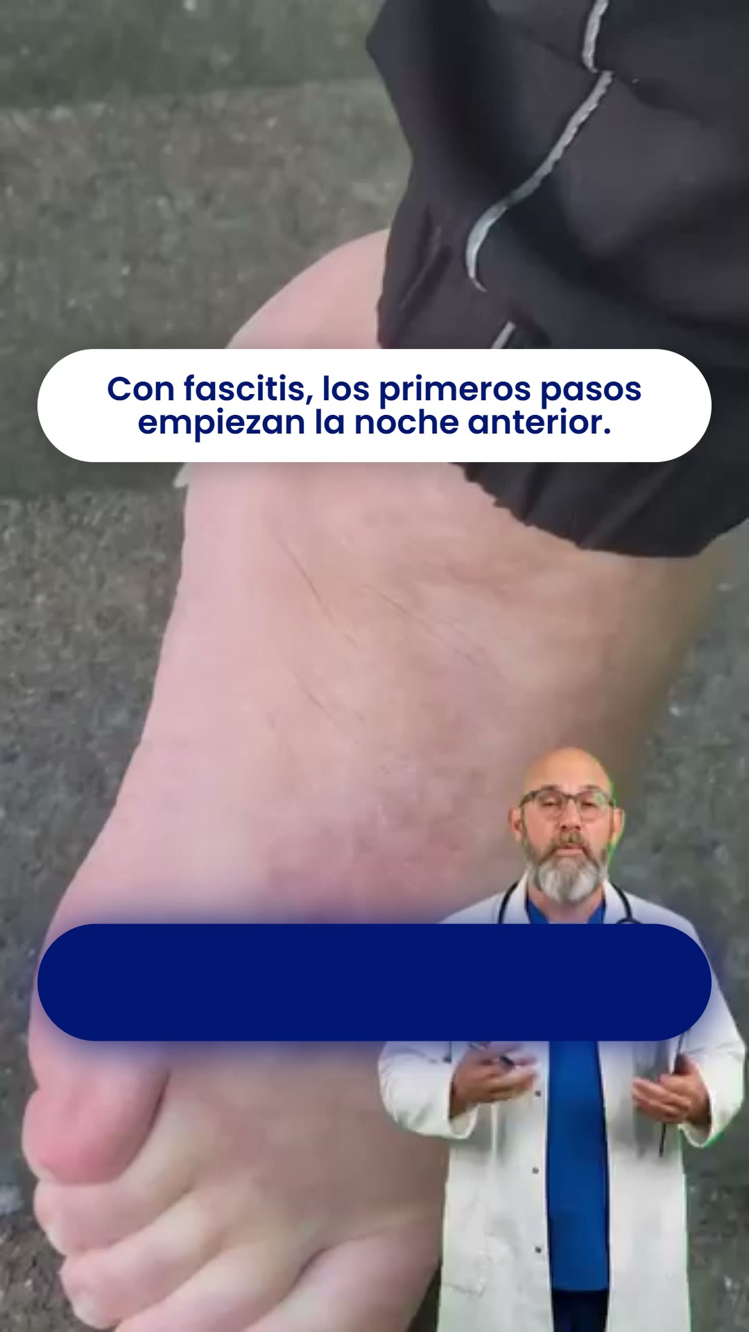 Calcetines para la fascitis plantar