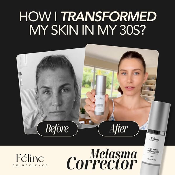 The Dark Spot Myth: The Real Reason Spots Keep Coming Back