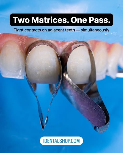 Anterior Sectional Matrices — All-In, No Hidden Fees.