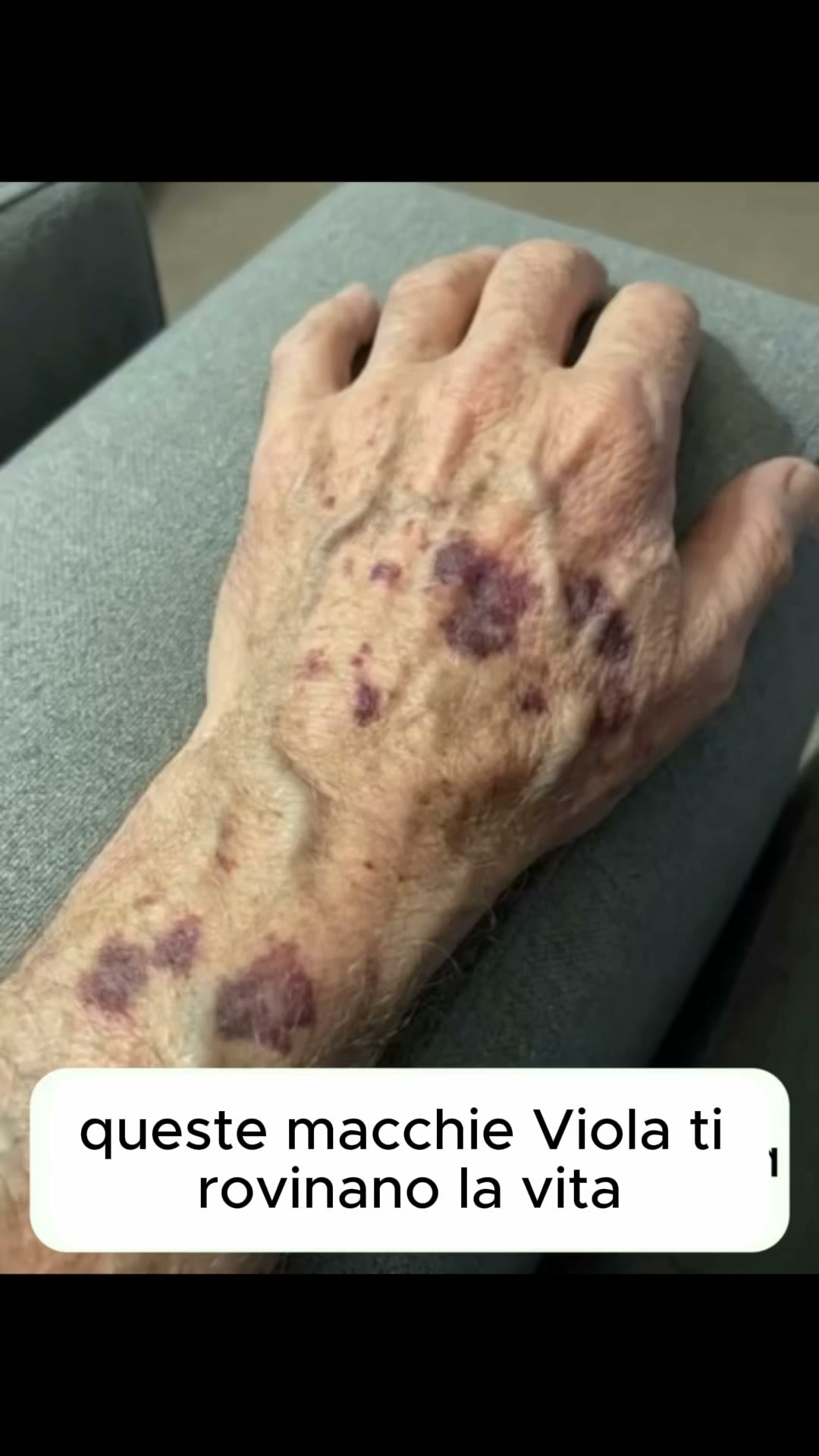 Anúncio de Livenia Derm