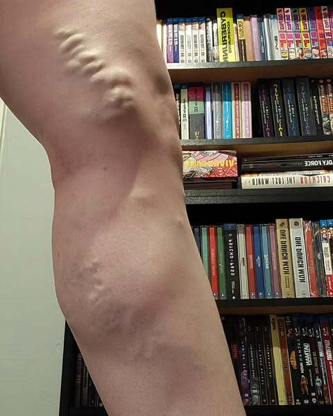 Your Vein Scan Doesn't Decide How You Feel