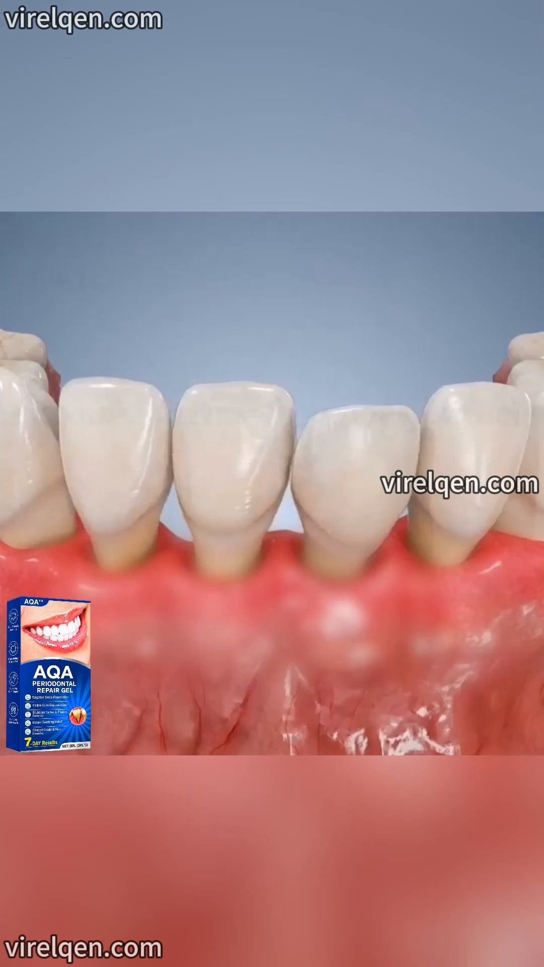 Are Your Teeth Getting Loose?