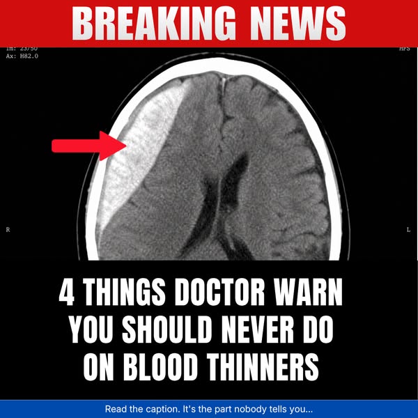 Doctors Warn: Avoid These 4 Blood Thinner Mistakes
