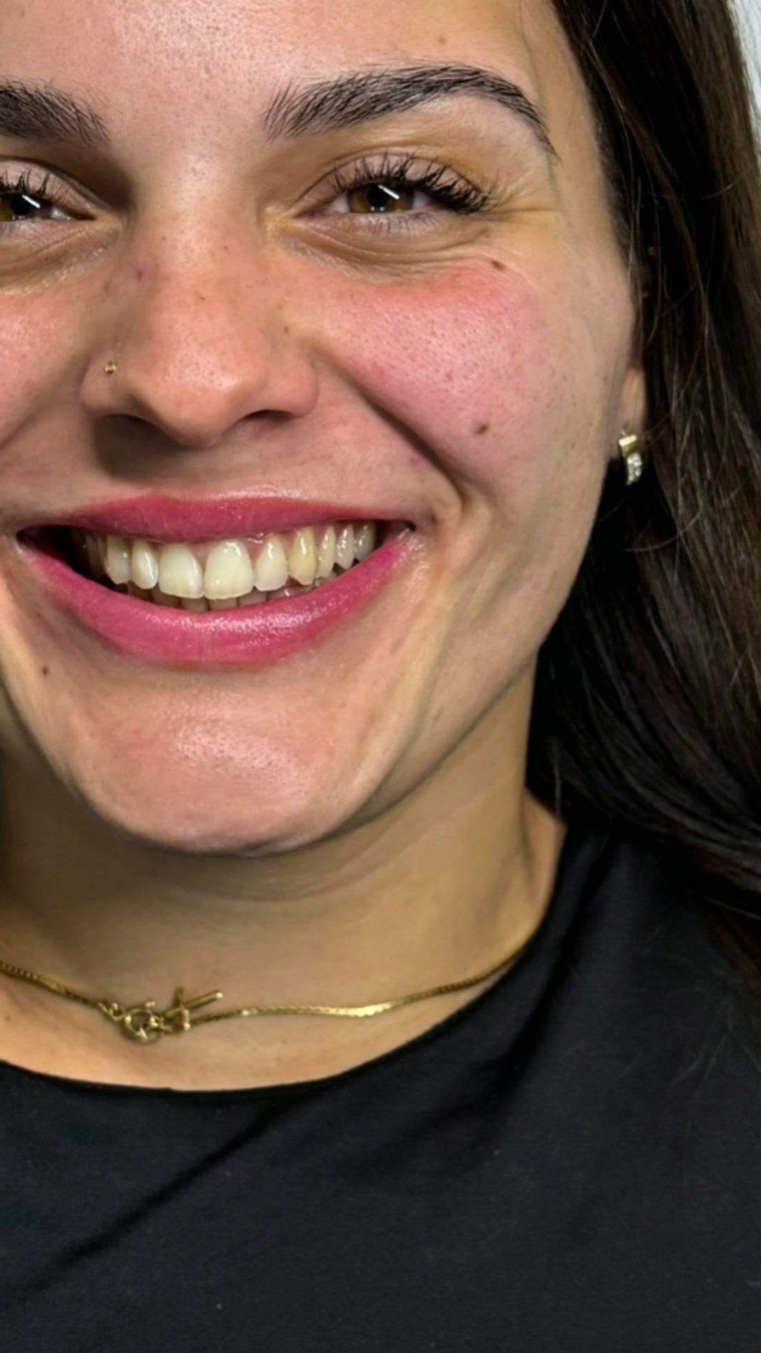 Labios Naturais