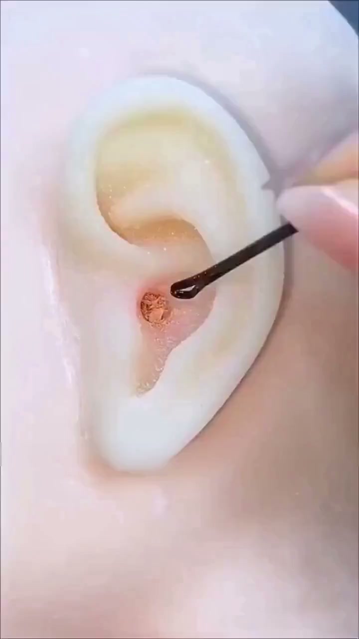 Anúncio de Mapeelow