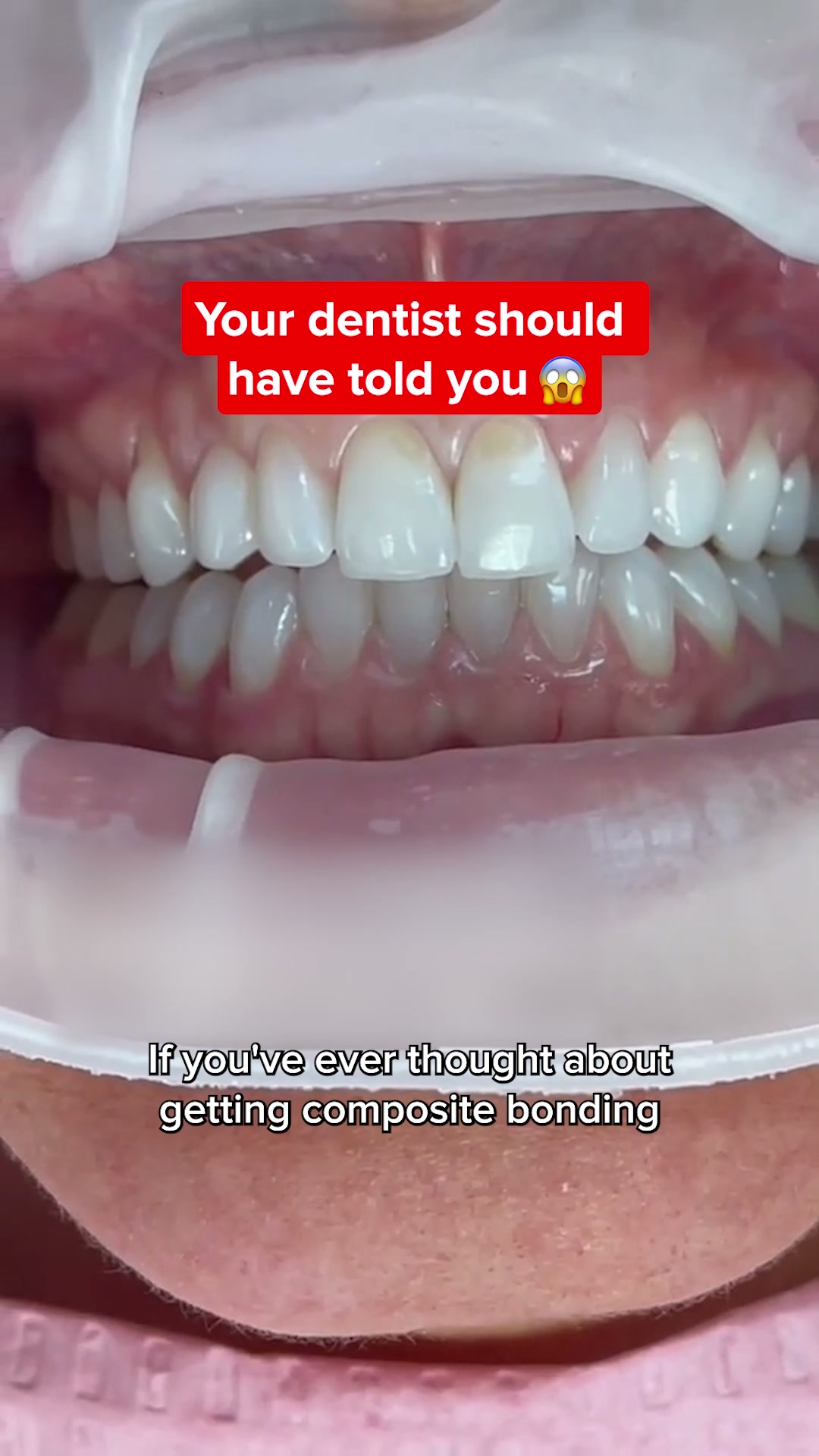 Back in Stock. Whiter Teeth Fast.