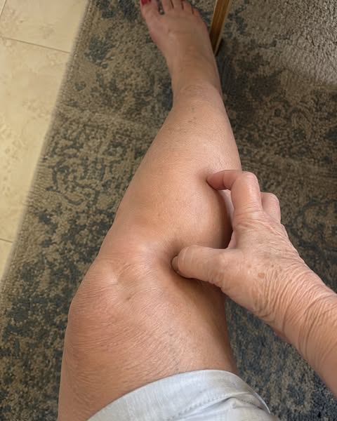 A neurologist told me a 'secret' why sciatica never heals
