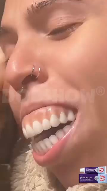 Tired of Your Dentures Slipping? Try This Instead.