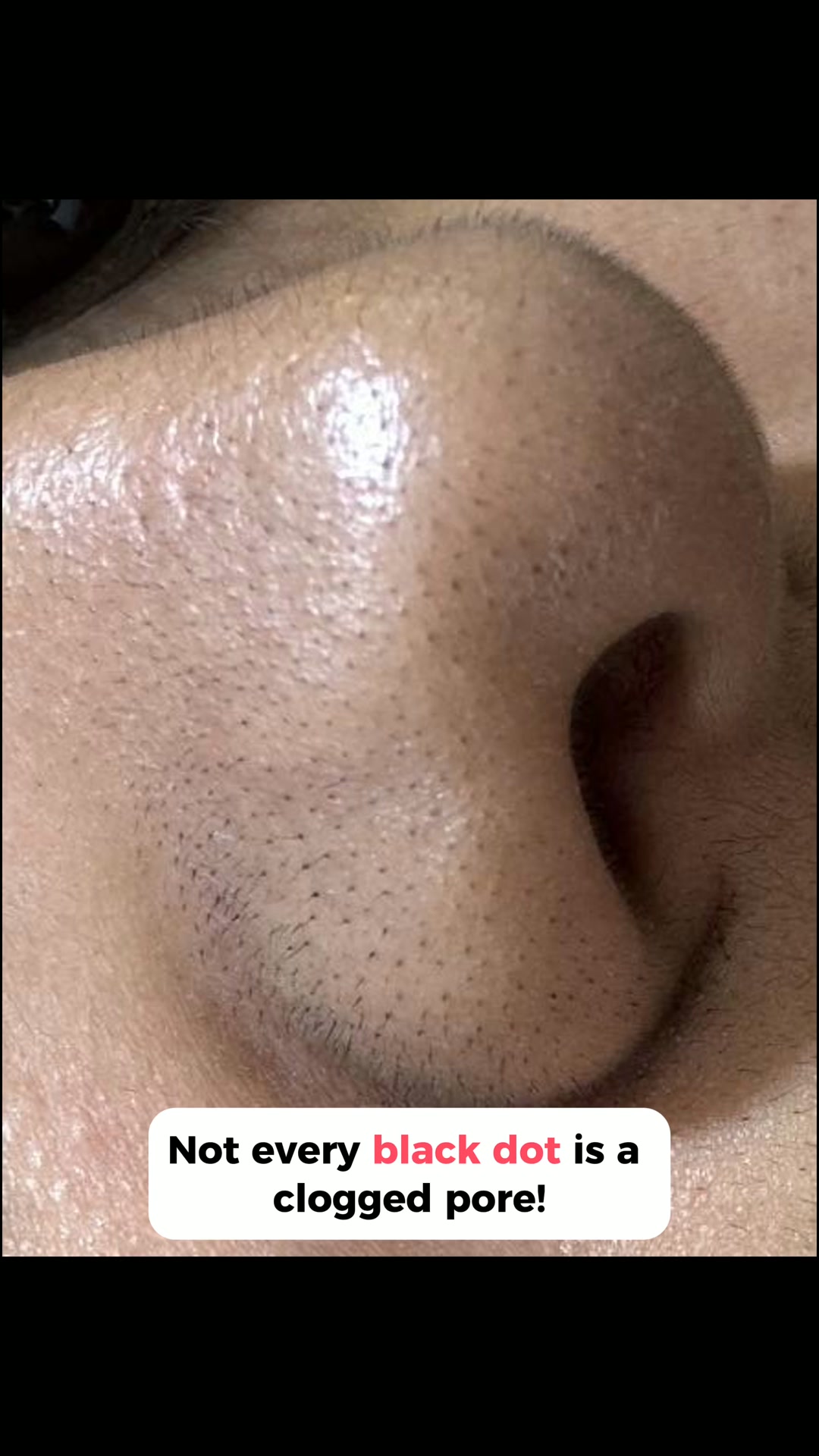Tiny Hairs. One Satisfying Peel.