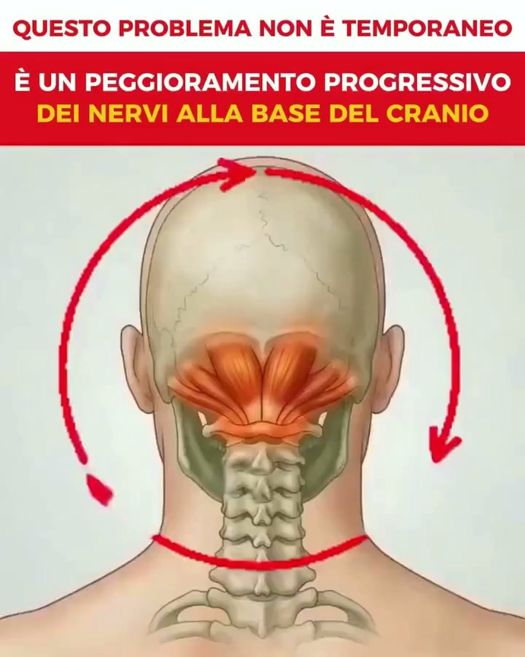 Empieza Leve, Luego Empeora