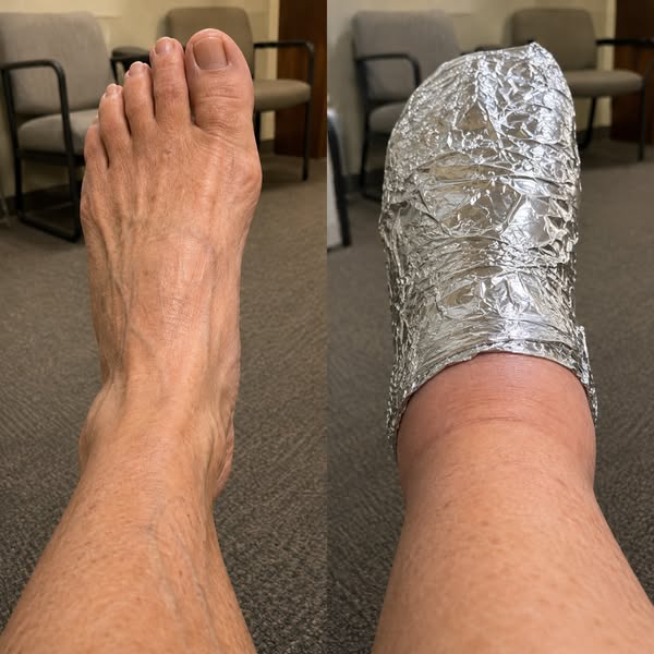 Put an End to Neuropathy Pain for Good?