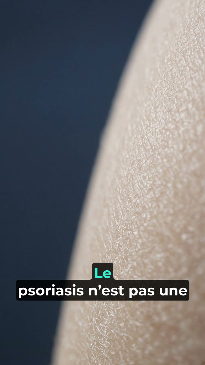 Enfin un soin qui apaise vraiment votre peau