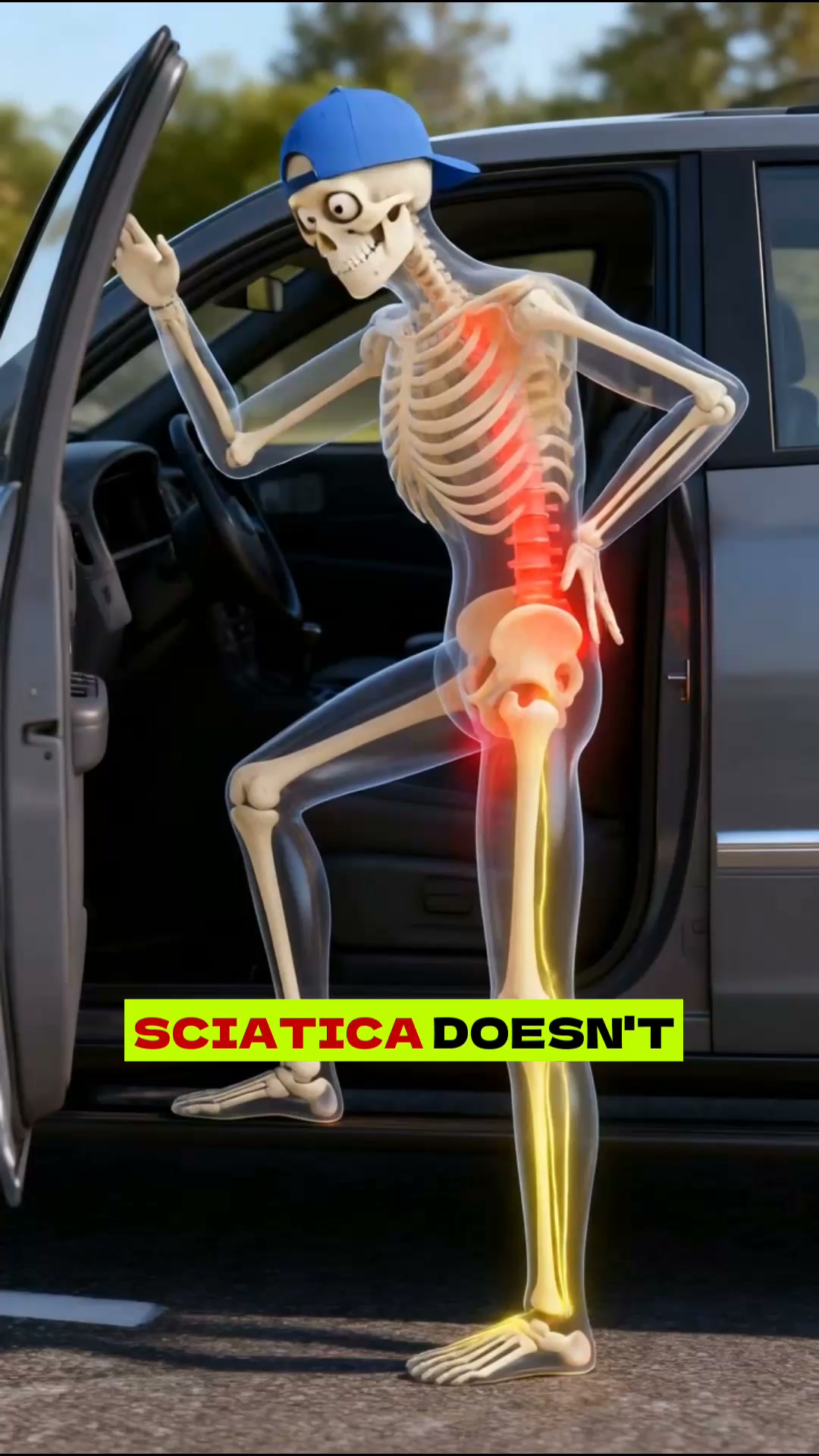 a realistic fix for sciatica