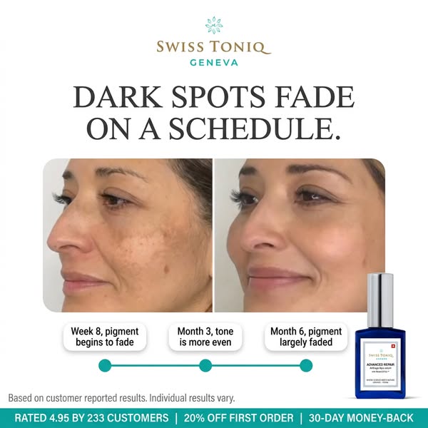 Sun Damage Fades Slower At 40
