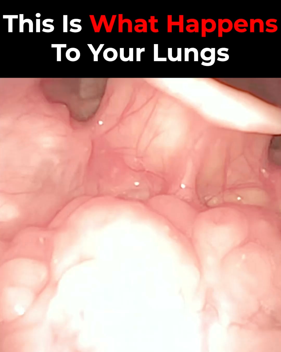 Fix Snoring & Sleepless Nights