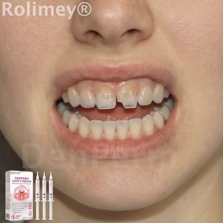 Cavity Repair FDA-Recognized 10% Nano-Hydroxyapatite (NH-10) | Delivery within 2-4 working days | Full refund guarantee