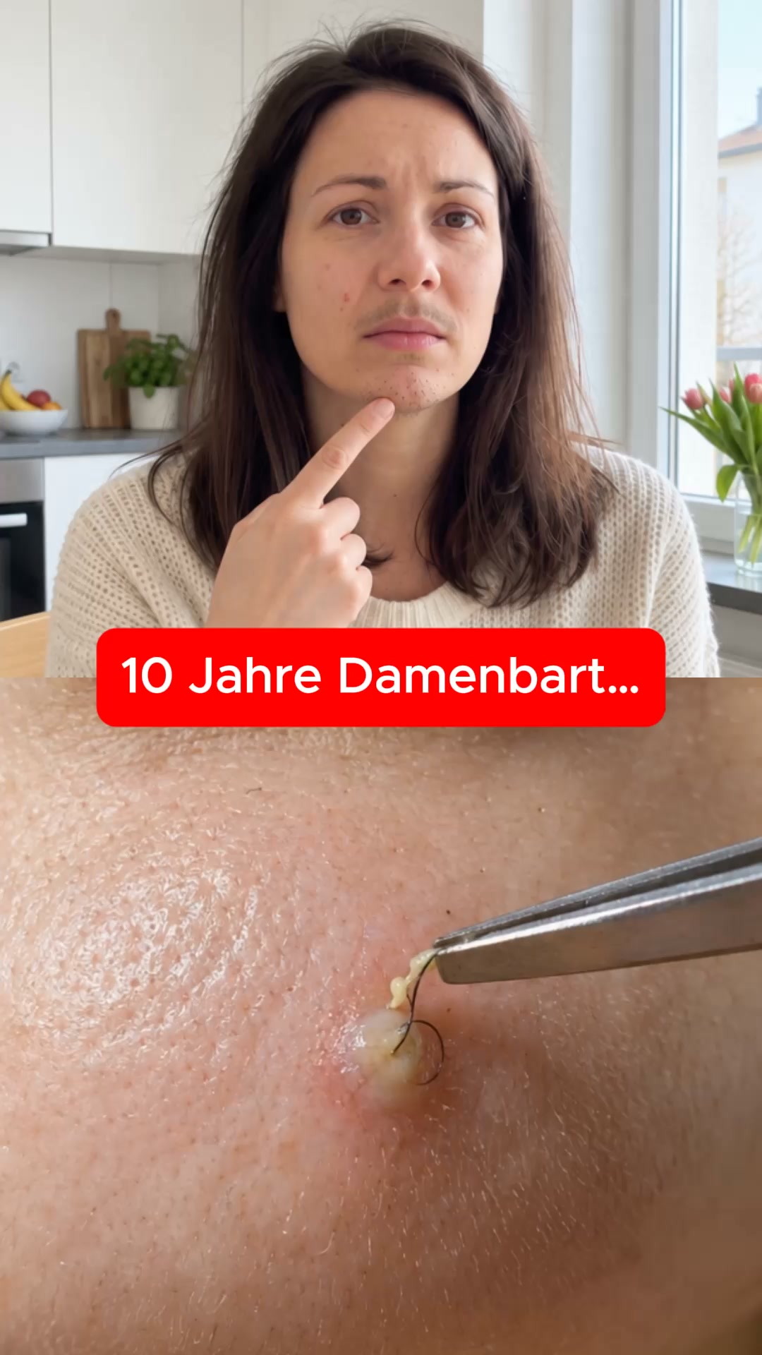 Damenbart? Hör auf zu rasieren, zupfen oder Lasern!