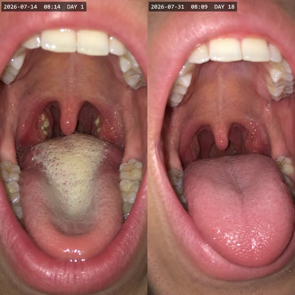 To people who have great hygiene and still can't get rid of bad breath — here's why nothing has worked.