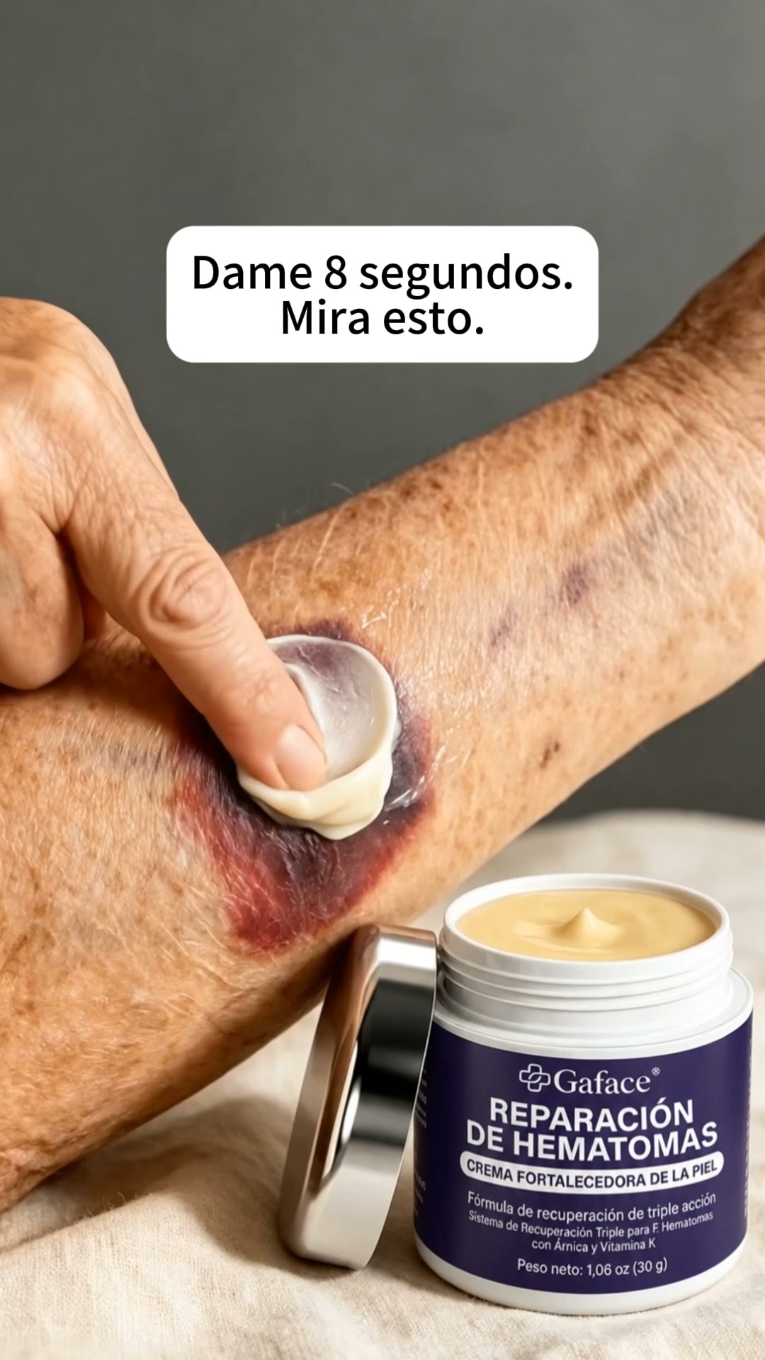 ¿¡MORETONES DESAPARECEN EN 8 SEGUNDOS?! ¡No vas a creer lo que ves!
