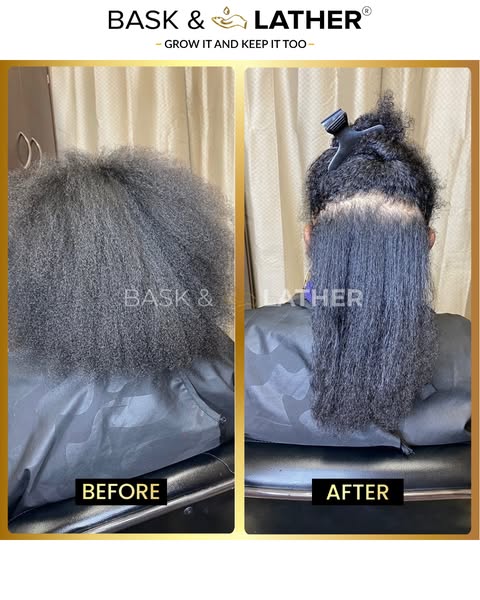 Scalp Stimulator