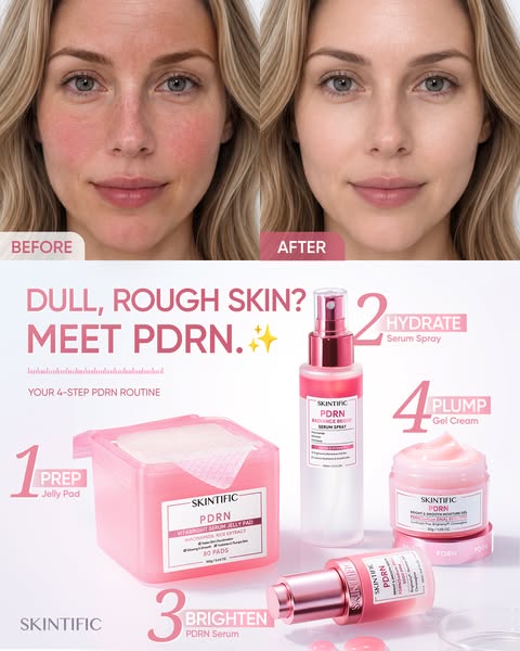 Give Rough, Tired-Looking Skin the PDRN Treatment
