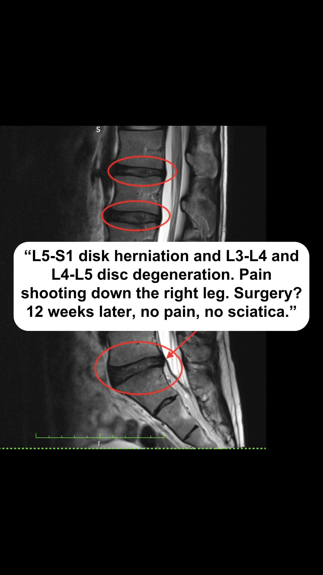 Fix What's Causing the Pain – Take the Test