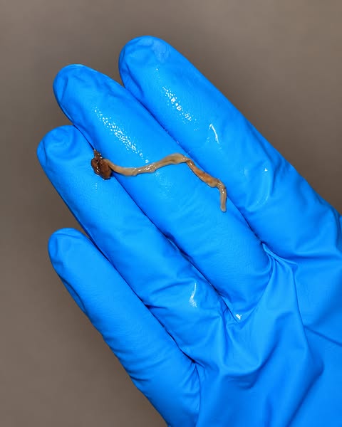 The Hidden Gut Clue We Nearly Ignored