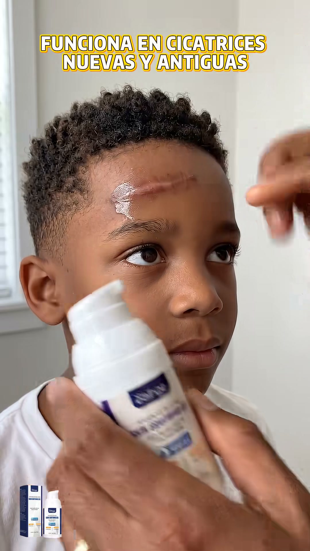 Medical‑Grade Silicone Gel for New & Old Scars