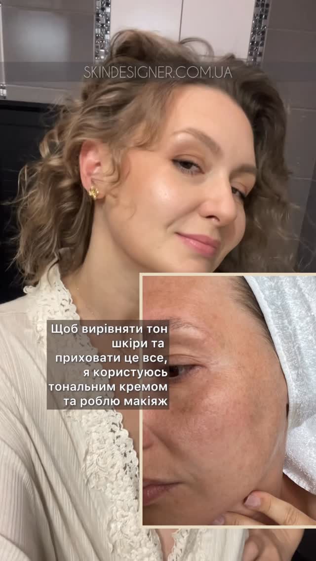 Anúncio de Skin Designer