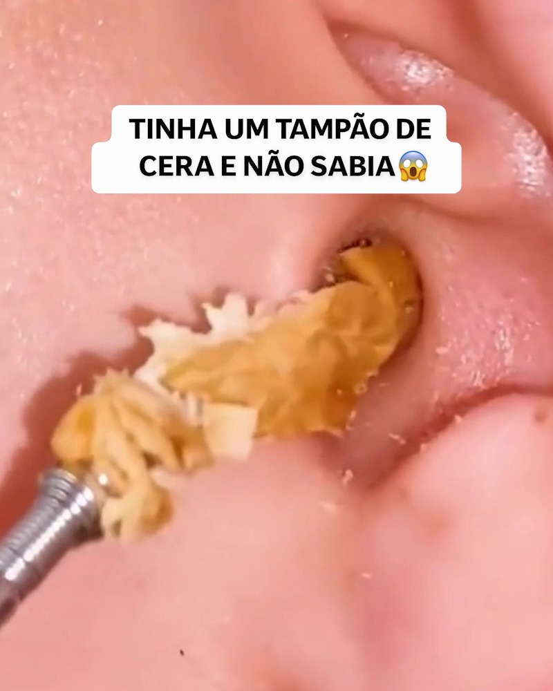 Cobrança Disponível