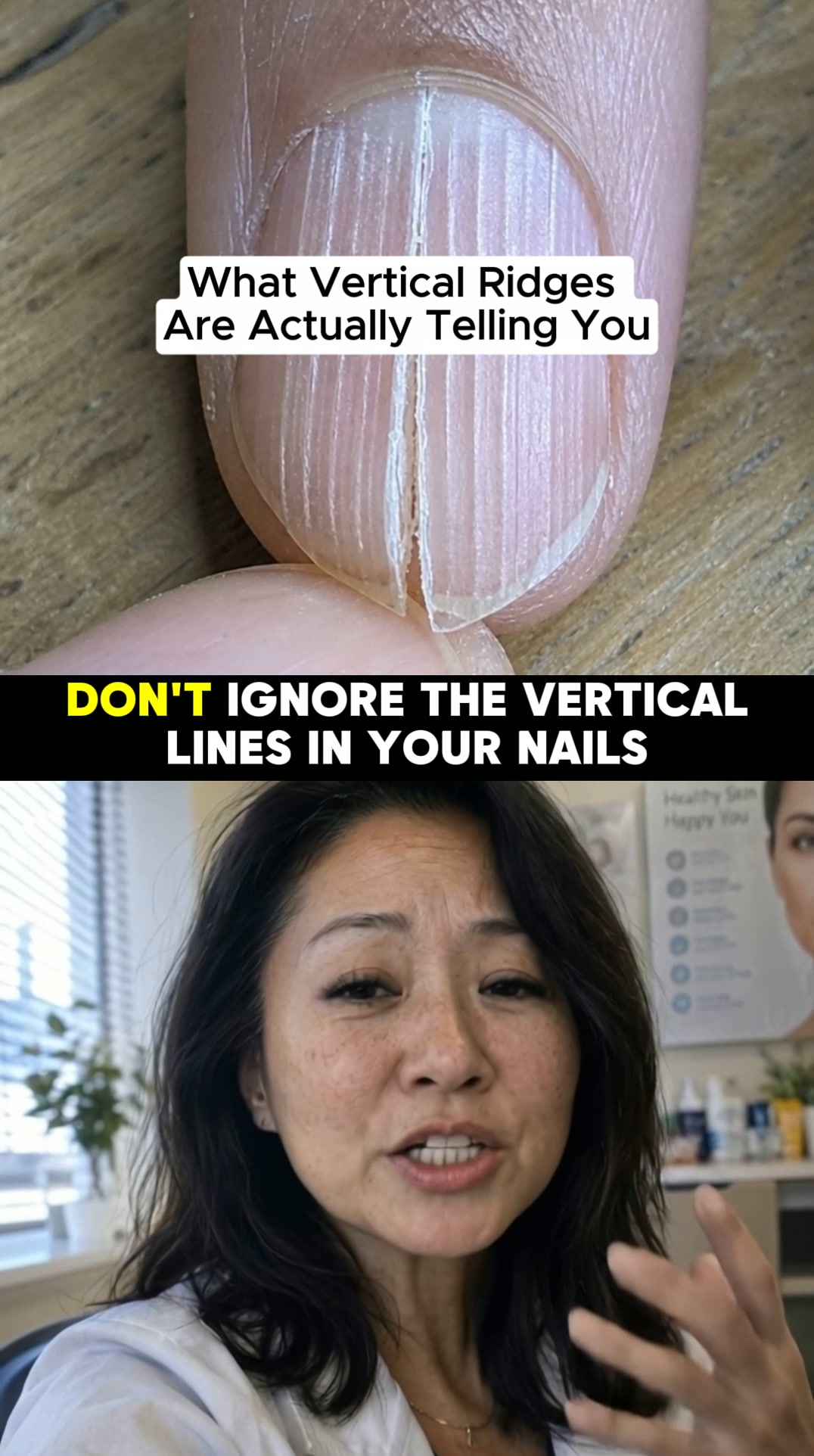 Why Nails Break After 50