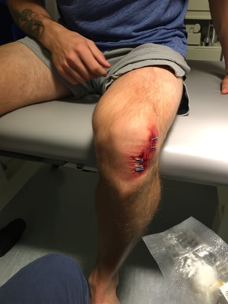Read This If You Have Bad Knees