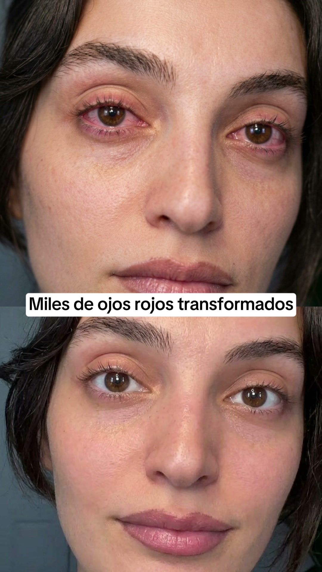 Solución en 5 minutos para ojos secos