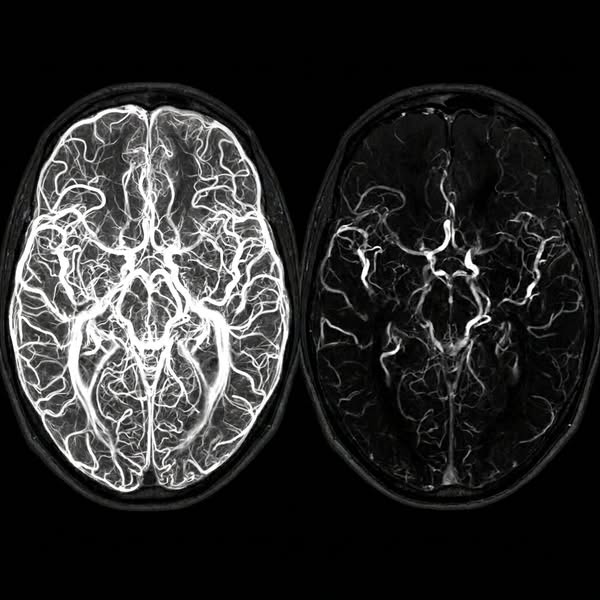 Ripara il cervello a livello cellulare