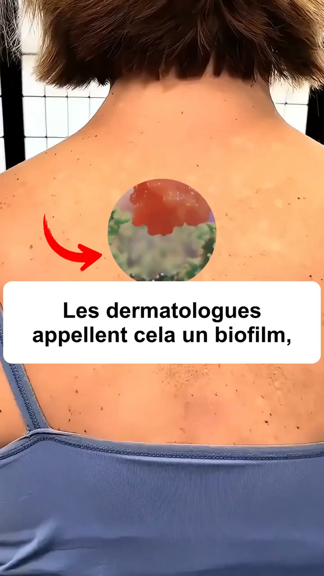 Une peau renouvelée